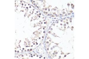 Immunohistochemistry of paraffin-embedded rat testis using P-MYC-T58 antibody (ABIN3019538, ABIN3019539, ABIN3019540 and ABIN6225454) at dilution of 1:100 (40x lens). (c-MYC anticorps  (pThr58))