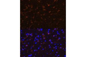 Immunofluorescence analysis of rat brain using S100B Rabbit mAb (ABIN7270131) at dilution of 1:100 (40x lens).