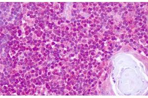 Image no. 2 for anti-Transcription Factor 4 (TCF4) (N-Term) antibody (ABIN6749785)