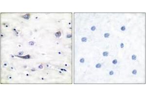 Immunohistochemistry analysis of paraffin-embedded human brain, using GluR1 (Phospho-Ser863) Antibody. (Glutamate Receptor 1 anticorps  (pSer863))