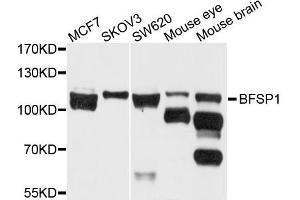 Western blot analysis of extract of various cells, using BFSP1 antibody. (Filensin anticorps)