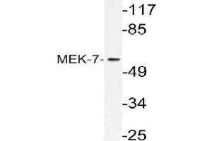 Western blot (WB) analysis of MEK-7 antibody in extracts from HeLa cells. (MAP2K7 anticorps)