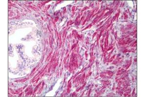Human Prostate, Smooth Muscle: Formalin-Fixed, Paraffin-Embedded (FFPE) (PMEPA1 anticorps)