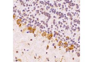 Immunohistochemistry of paraffin embedded rat bulbus olfactorius using UQCC (ABIN7076094) at dilution of 1: 1000 (400x lens)