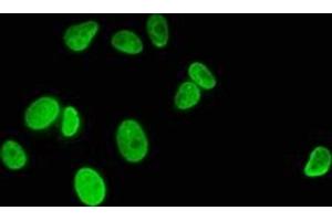 Immunofluorescence staining of MCF-7 cells with ABIN7139594 at 1:5, counter-stained with DAPI. (HIST1H1C anticorps  (meLys186))