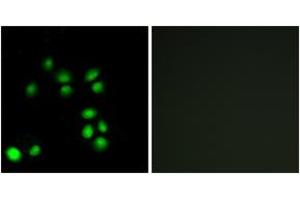 Immunofluorescence analysis of A549 cells, using EXO1 Antibody. (Exonuclease 1 anticorps  (AA 61-110))
