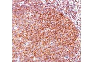 IHC staining of human tonsil with Bcl10 antibody (BL10/411). (BCL10 anticorps  (AA 122-168))