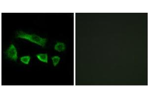 Immunofluorescence analysis of A549 cells, using NT5C1B antibody. (NT5C1B anticorps  (Internal Region))