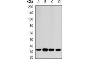 Western blot analysis of HAGH expression in HepG2 (A), mouse liver (B), mouse heart (C), rat kidney (D) whole cell lysates. (HAGH anticorps)