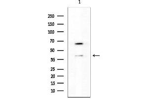 Western blot analysis of lysates from HUVEC cells(heat-shock treatment), using GATA1 Mouse Monoclonal Antibody.