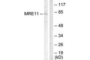 Western blot analysis of extracts from Jurkat cells, treated with UV 15', using MRE11 (Ab-264) Antibody. (Mre11 anticorps  (AA 230-279))