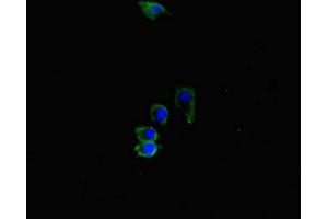 Immunofluorescent analysis of HepG2 cells using ABIN7169164 at dilution of 1:100 and Alexa Fluor 488-congugated AffiniPure Goat Anti-Rabbit IgG(H+L) (ACVRL1 anticorps  (AA 22-118))