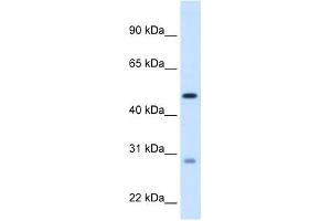 ECHS1 antibody used at 1. (ECHS1 anticorps  (C-Term))