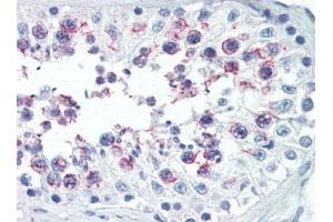 Human Testis (formalin-fixed, paraffin-embedded) stained with SMURF1followed by biotinylated goat anti-rabbit IgG secondary antibody, alkaline phosphatase-streptavidin and chromogen. (SMURF1 anticorps  (N-Term))