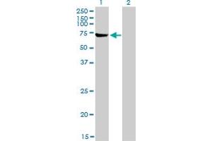 Western Blotting (WB) image for anti-ATP-Binding Cassette, Sub-Family F (GCN20), Member 2 (ABCF2) (AA 1-110) antibody (ABIN599114) (ABCF2 anticorps  (AA 1-110))