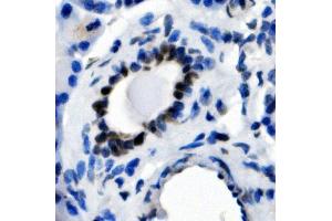 IHC analysis of NFIC using anti-NFIC antibody (ABIN7600653).