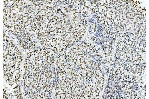IHC analysis of Cyclophilin E/PPIE using anti-Cyclophilin E/PPIE antibody (ABIN7599242). (PPIE anticorps  (AA 1-301))