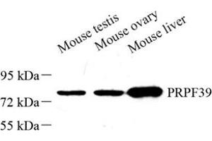 Western blot analysis of PRPF39 (ABIN7075170) at dilution of 1: 500