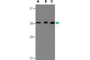 Western blot analysis of BRCC3 in MCF-7 cell lysate with BRCC3 polyclonal antibody  at (A) 0. (BRCC3 anticorps  (N-Term))