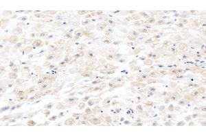 Detection of MMP8 in Human Placenta Tissue using Monoclonal Antibody to Matrix Metalloproteinase 8 (MMP8) (MMP8 anticorps  (AA 101-467))