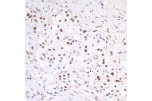 Immunohistochemistry (IHC) image for anti-Cleavage Stimulation Factor, 3' Pre-RNA, Subunit 2, 64kDa (CSTF2) (AA 375-425) antibody (ABIN7454717)