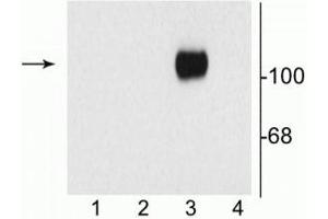 Western blot of 10 µg of HEK 293 cells showing specific immunolabeling of the ~120 kDa NR1 subunit of the NMDA receptor containing the C1 splice variant insert (in lane 3). (GRIN1/NMDAR1 anticorps)