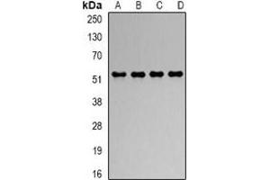 Western blot analysis of RbAp48 expression in Hela (A), Jurkat (B), NIH3T3 (C), COS7 (D) whole cell lysates. (Retinoblastoma Binding Protein 4 anticorps)