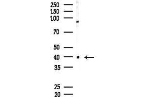 anti-Sorbitol Dehydrogenase (SORD) (Internal Region) antibody