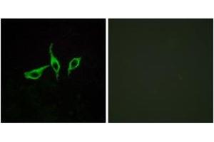 Immunofluorescence analysis of LOVO cells, using GPR120 Antibody.