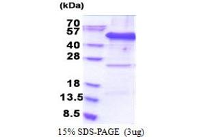 SDS-PAGE (SDS) image for Eukaryotic Translation Initiation Factor 3 Subunit F (EIF3F) (AA 1-357) protein (His tag) (ABIN5853278) (EIF3F Protein (AA 1-357) (His tag))