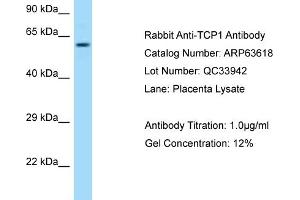 Western Blotting (WB) image for anti-T-Complex 1 (TCP1) (C-Term) antibody (ABIN2789568) (TCP1 alpha/CCTA anticorps  (C-Term))