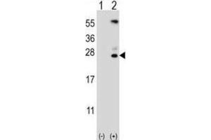 Western Blotting (WB) image for anti-Kallikrein 6 (KLK6) antibody (ABIN3002615) (Kallikrein 6 anticorps)