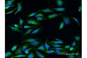 Immunofluorescence of purified MaxPab antibody to UQCRC2 on HeLa cell.