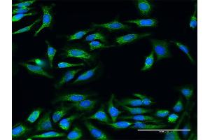 Immunofluorescence of purified MaxPab antibody to UQCRC2 on HeLa cell. (UQCRC2 anticorps  (AA 1-453))