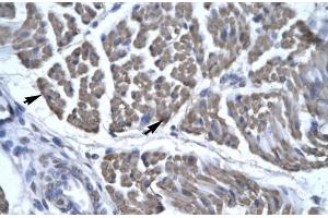 Human Skeletal Muscle; EYA3 antibody - middle region in Human Skeletal Muscle cells using Immunohistochemistry (EYA3 anticorps  (Middle Region))