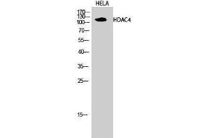 Western Blotting (WB) image for anti-Histone Deacetylase 4 (HDAC4) (Tyr493) antibody (ABIN3184987) (HDAC4 anticorps  (Tyr493))