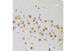Immunohistochemistry of paraffin-embedded rat brain using HNRNPA1 Antibody (ABIN5975570) at dilution of 1/100 (40x lens). (HNRNPA1 anticorps)