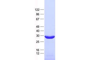 Validation with Western Blot