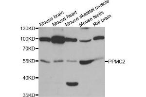 Western Blotting (WB) image for anti-Pyruvate Dehydrogenase Phosphatase (PDP) antibody (ABIN1980348) (PDP anticorps)