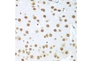 Immunohistochemistry of paraffin-embedded mouse brain using BCAS2 antibody.