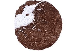 Esophagus squamous epithelium A strong KRT15 immunostaining is always found in all cell layers of all non keratinizing and keratinizing squamous epithelium