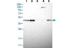 Western blot analysis of Lane 1: RT-4, Lane 2: U-251 MG, Lane 3: Human Plasma, Lane 4: Liver, Lane 5: Tonsil with TMED2 polyclonal antibody  at 1:250-1:500 dilution.