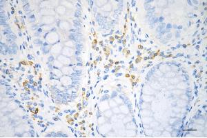 anti-Eukaryotic Translation Elongation Factor 2 (EEF2) antibody