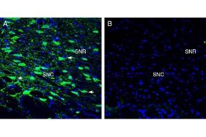 Expression of Tetraspanin 7 in the rat substantia nigra region. (Tetraspanin 7 anticorps  (Extracellular))