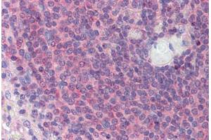 Human Spleen (formalin-fixed, paraffin-embedded) stained with TGFB1I1 antibody ABIN462214 followed by biotinylated goat anti-rabbit IgG secondary antibody ABIN481713, alkaline phosphatase-streptavidin and chromogen.