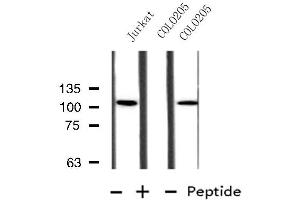 Western blot analysis of extracts from Jurkat/COLO205 cells, using MBTPS1 antibody. (MBTPS1 anticorps  (Internal Region))