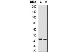 Western blot analysis of CDCA7 expression in A431 (A), U2OS (B) whole cell lysates. (CDCA7 anticorps  (Center))