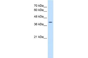 WB Suggested Anti-WNT2B Antibody Titration:  0.