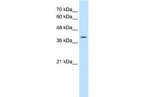 WB Suggested Anti-WNT2B Antibody Titration:  0. (WNT2B anticorps  (N-Term))
