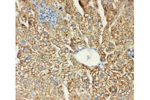 Anti-MTCO1 antibody, IHC(P): Mouse Liver Tissue (COX1 anticorps  (C-Term))